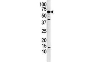 Western blot analysis of Calcineurin antibody and mouse kidney tissue lysate.