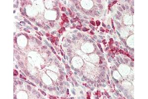 Formalin-fixed and paraffin-embedded H.