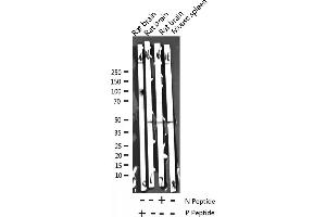 Western blot analysis of Phospho-Caspase 9 (Thr125) expression in various lysates