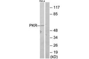 Western blot analysis of extracts from HeLa, using PKR (Ab-446) Antibody. (EIF2AK2 anticorps  (AA 413-462))