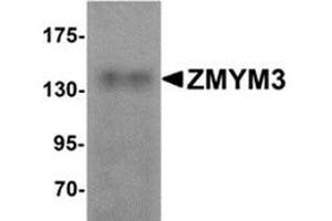Western blot analysis of ZMYM3 in human brain tissue lysate with ZMYM3 antibody at 1 μg/ml. (ZMYM3 anticorps  (N-Term))