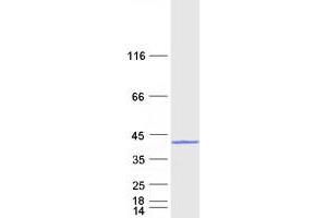 Validation with Western Blot
