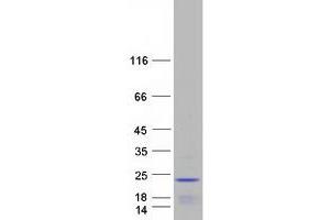 Validation with Western Blot