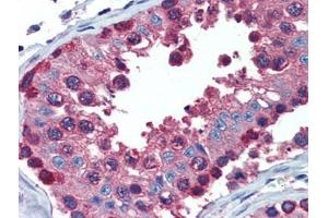 Testis, Human: Formalin-Fixed, Paraffin-Embedded (FFPE) (PDIA4 anticorps  (AA 623-638))