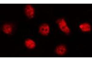ABIN6278559 staining LOVO by IF/ICC. (CLK4 anticorps  (Internal Region))