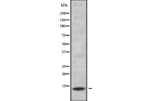 Western blot analysis of KCNE3 using Jurkat whole cell lysates (Kcne3 anticorps  (Internal Region))