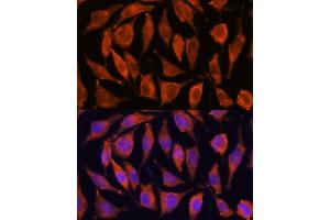Immunofluorescence analysis of L929 cells using TNFL2 antibody (ABIN6133093, ABIN6149298, ABIN6149299 and ABIN6217788) at dilution of 1:100.
