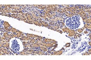 Detection of MAPK14 in Porcine Kidney Tissue using Polyclonal Antibody to Mitogen Activated Protein Kinase 14 (MAPK14) (MAPK14 anticorps  (AA 19-279))