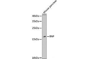 Western blot analysis of extracts of Mouse pancreas using BNP Polyclonal Antibody at dilution of 1:1000. (BNP anticorps)