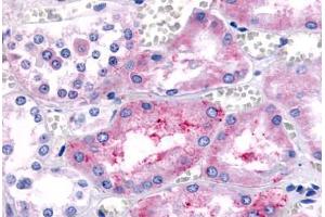 Anti-PTGER1 / EP1 antibody  ABIN1049253 IHC staining of human kidney, renal tubules.