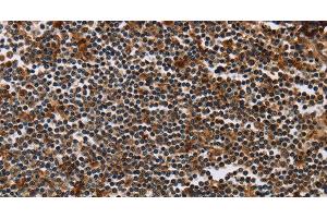 Immunohistochemistry of paraffin-embedded Human tonsil using MAGEA3 Polyclonal Antibody at dilution of 1:50 (MAGEA3 anticorps)