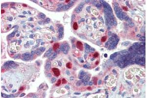 Placenta, Human: Formalin-Fixed, Paraffin-Embedded (FFPE)