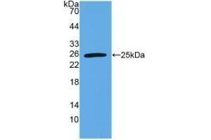 Detection of Recombinant VEGI, Human using Polyclonal Antibody to TNF Like Ligand 1A (TL1A)