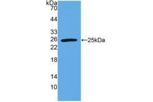 Detection of Recombinant VEGI, Human using Polyclonal Antibody to TNF Like Ligand 1A (TL1A) (TNF Like Ligand 1A (AA 67-251) anticorps)