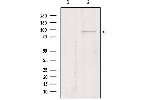 Western blot analysis of extracts from Mouse myeloma, using TMEM173/STING antibody. (STING/TMEM173 anticorps  (Internal Region))