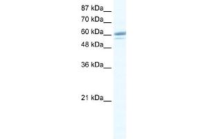 WB Suggested Anti-ZNF232 Antibody Titration:  0. (ZNF232 anticorps  (Middle Region))