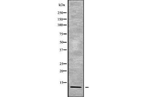 Western blot analysis of RPAB4 using Jurkat whole cell lysates