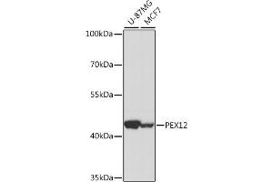 Western blot analysis of extracts of various cell lines, using PEX12 antibody (ABIN7269246) at 1:1000 dilution. (PEX12 anticorps  (AA 290-359))