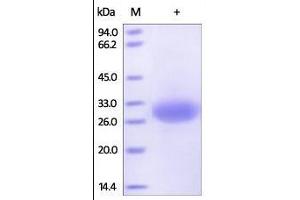 Human Mesothelin (37-286), His Tag on SDS-PAGE under reducing (R) condition. (Mesothelin Protein (MSLN) (AA 37-286) (His tag))