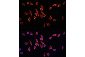 Immunofluorescence analysis of L929 cells using Neuropilin-1 (Neuropilin-1 (NRP1)) antibody (ABIN7268892) at dilution of 1:100.