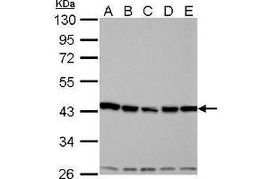 WB Image Aurora A antibody [C3], C-term detects AURKA protein by Western blot analysis.