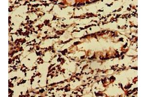 Immunohistochemistry of paraffin-embedded human appendix tissue using ABIN7157550 at dilution of 1:100 (KIDINS220 anticorps  (AA 1077-1370))