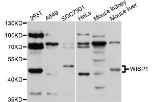 Western blot analysis of extracts of various cell lines, using WISP1 antibody (ABIN1875349) at 1:1000 dilution. (WISP1 anticorps)