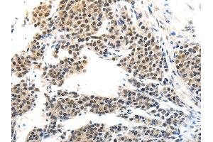 Immunohistochemistry (IHC) image for anti-Melanoma Antigen Family A, 6 (MAGEA6) antibody (ABIN5957147) (MAGEA6 anticorps)