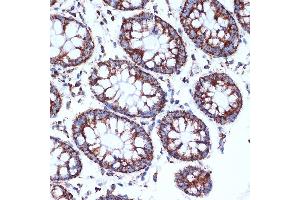 Immunohistochemistry of paraffin-embedded human colon using CLPP Rabbit mAb (ABIN1682296, ABIN3017596, ABIN3017597 and ABIN7101508) at dilution of 1:100 (40x lens).