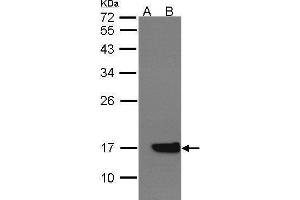 WB Image Western Blot analysis of CYB5A expression in transfected 293T cell line by CYB5A polyclonal antibody. (CYB5A anticorps)