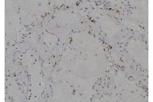 ABIN6277204 at 1/100 staining Human lung tissue by IHC-P. (Histone 3 anticorps  (H3K79me))