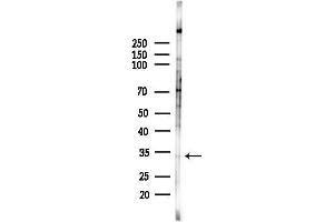 anti-2,4-Dienoyl CoA Reductase 2, Peroxisomal (DECR2) (Internal Region) antibody