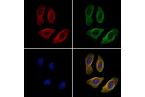 ABIN6263216 and ABIN6269229 staining Hela cells by IF/ICC. (MEK2 anticorps  (C-Term))
