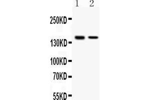 Western blot analysis of SAFB expression in HELA whole cell lysates ( Lane 1) and MCF-7 whole cell lysates ( Lane 2).