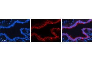 GCLC antibody - N-terminal region (ARP54576_P050) Catalog Number: ARP54576_P050  Formalin Fixed Paraffin Embedded Tissue: Human Bronchial Epithelial Tissue  Observed Staining: Cytoplasm and membrane of bronchial epithelial tissue Primary Antibody Concentration: 1:600  Secondary Antibody: Donkey anti-Rabbit-Cy3  Secondary Antibody Concentration: 1:200  Magnification: 20X  Exposure Time: 0.
