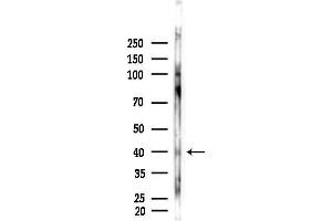 anti-Aurora Kinase B/C (AURKB/C) (pThr202), (pThr236) antibody