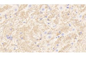 Detection of TUBb1 in Mouse Cerebellum Tissue using Polyclonal Antibody to Tubulin Beta 1 (TUBb1)