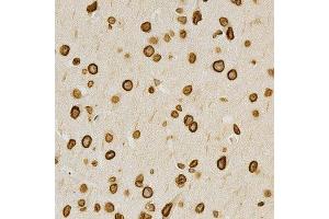 Immunohistochemistry of paraffin-embedded mouse brain using LMNA antibody at dilution of 1:200 (x400 lens).