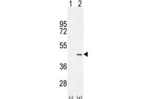 Western Blotting (WB) image for anti-Cochlin (COCH) antibody (ABIN2996145)