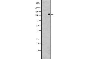 Western blot analysis of GPR64 expression in A431 whole cell lysate ,The lane on the left is treated with the antigen-specific peptide. (GPR64 anticorps  (Internal Region))