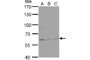 WB Image NPAS1 antibody detects NPAS1 protein by Western blot analysis. (NPAS1 anticorps)