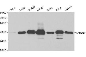 Western blot analysis of extracts of various cell lines, using TARDBP antibody (ABIN5970529) at 1/1000 dilution. (TARDBP anticorps)