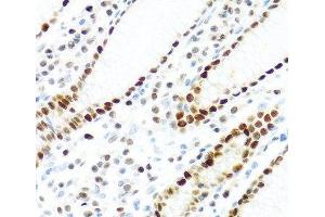 Immunohistochemistry of paraffin-embedded Human stomach using KHDRBS2 Polyclonal Antibody at dilution of 1:100 (40x lens). (KHDRBS2 anticorps)