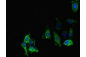Immunofluorescent analysis of Hela cells using ABIN7169250 at dilution of 1:100 and Alexa Fluor 488-congugated AffiniPure Goat Anti-Rabbit IgG(H+L)
