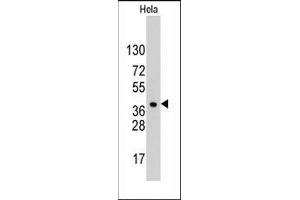 Western blot analysis of anti-HDGF Pab in Hela cell line lysates (35ug/lane). (HDGF anticorps  (C-Term))