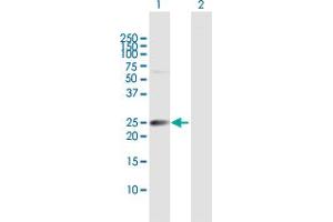 Western Blot analysis of IGSF6 expression in transfected 293T cell line by IGSF6 MaxPab polyclonal antibody. (IGSF6 anticorps  (AA 1-241))