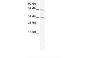 Image no. 1 for anti-SRY (Sex Determining Region Y)-Box 17 (SOX17) (AA 345-394) antibody (ABIN6735967) (SOX17 anticorps  (AA 345-394))