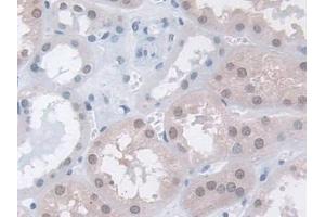 DAB staining on IHC-P; Samples: Human Kidney Tissue (MPP5 anticorps  (AA 455-675))