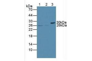 Rabbit Detection antibody from the kit in WB with Positive Control: Sample Lane1: Human Jurkat Cells; Lane2: Human U937 Cells; Lane3: Mouse Pancreas Tissue.
