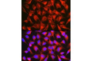Immunofluorescence analysis of HeLa cells using [KO Validated] CD171/L1CAM Rabbit pAb (ABIN6131538, ABIN6143053, ABIN6143054 and ABIN7101826) at dilution of 1:150 (40x lens).